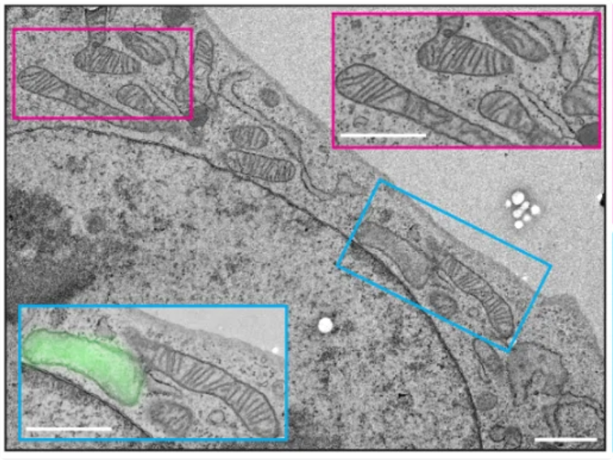 Organelle contacts